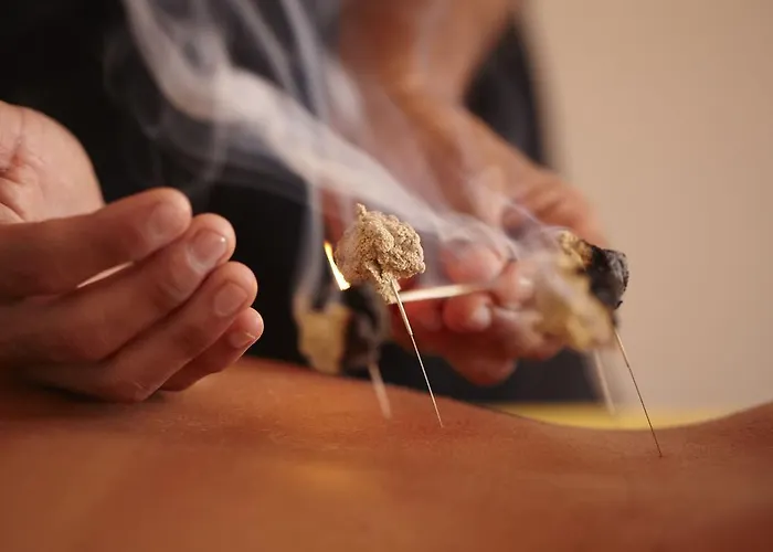 Alpino Atlantico Ayurveda Cure Centre - Adults Only 酒店 4*